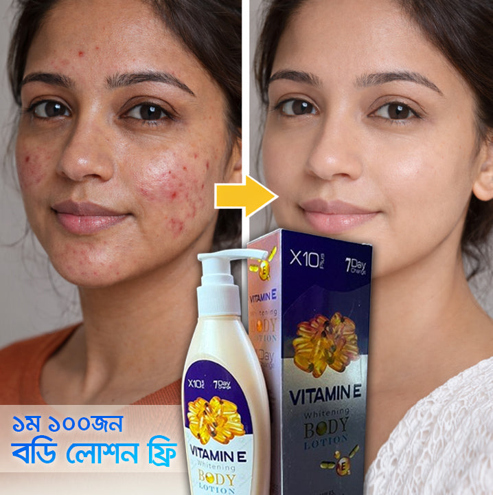 স্কিন ফর্সা ও গ্লো, দাগ, ব্রণ, মেছতা মাত্র ৭ দিনে ফলাফল ইনশাআল্লাহ