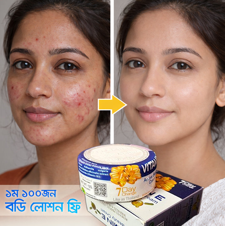 স্কিন ফর্সা ও গ্লো, দাগ, ব্রণ, মেছতা মাত্র ৭ দিনে ফলাফল ইনশাআল্লাহ