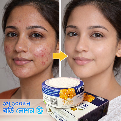 স্কিন ফর্সা ও গ্লো, দাগ, ব্রণ, মেছতা মাত্র ৭ দিনে ফলাফল ইনশাআল্লাহ