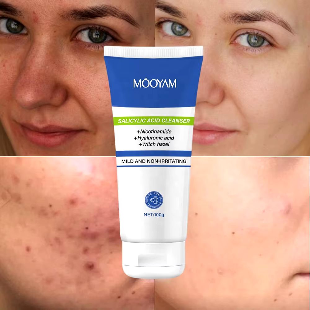 Mooyam Salicylic Acid Whitening & Acne Clear Face Wash